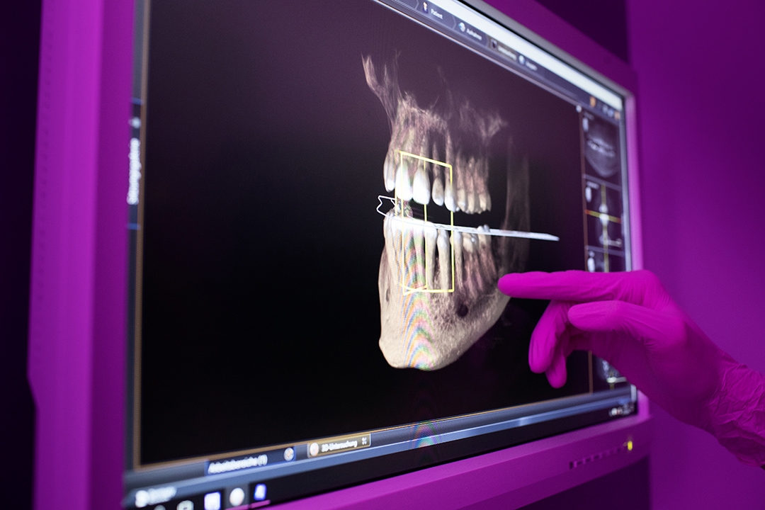 mkgChirurgikumLingen-therapiespektrum-Mund-und-Kieferchirurgie-roentgenaufnahmen